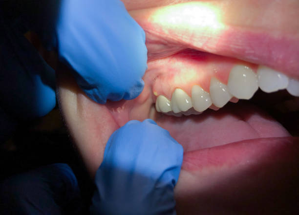 Best Broken or Cracked Tooth Emergency Dentist in Delphi, IN