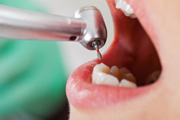 Best Pediatric Emergency Dentist in Delphi, IN